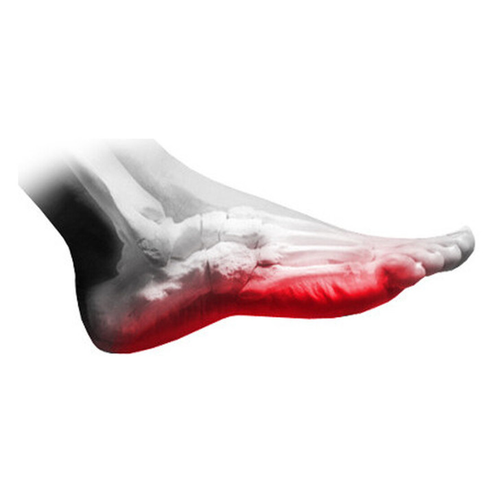 PLANTILLA HIPERALGIA | Iberoclinic.pt