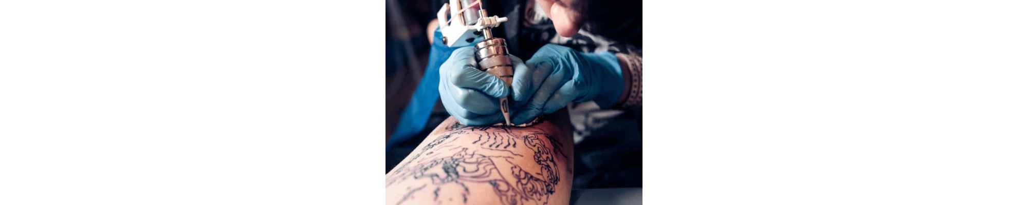 TATTOO | Iberoclinic